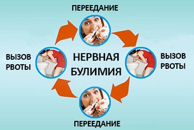 Лечение булимии в Винсадах
